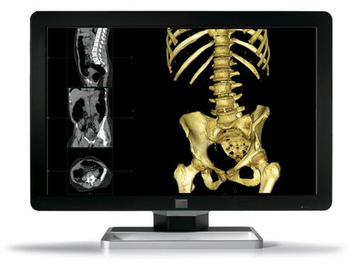 What Makes Barco Monitors Ideal for Surgical Environments