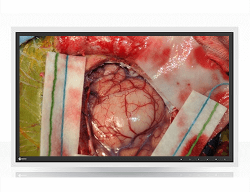 Surgical Monitors and Real-Time Imaging: Enhancing OR Collaboration