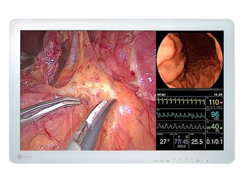 A Detailed Guide to Surgical Monitors