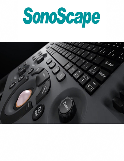 SonoScape