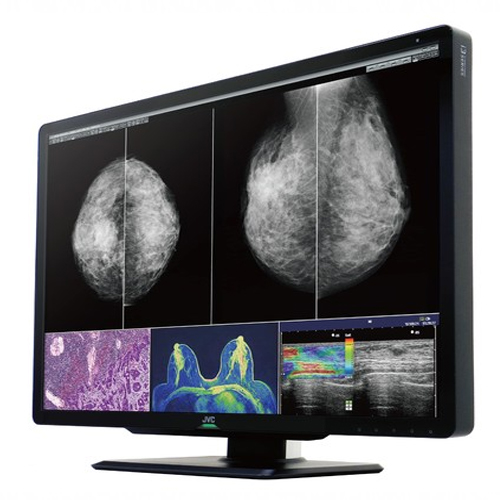 JVC CL-S1200 ( JVC CLS1200) 12MP Mammography Display