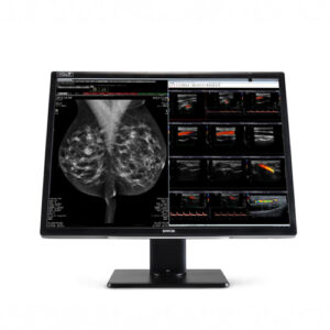 Barco Nio MDNC-12130, Barco Medical Monitors & Displays