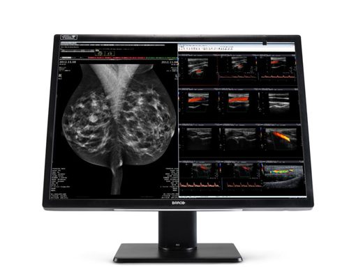 Hiliex – Your Premier Source for Barco Medical Monitors & Displays