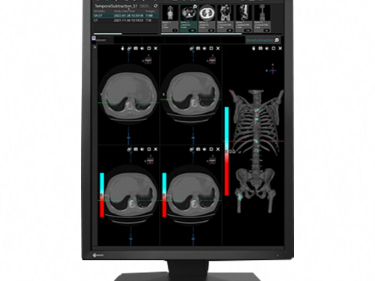 Imaging | Hiliex