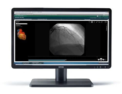 Reasons to Use Medical Grade Monitors in Diagnostic Imaging