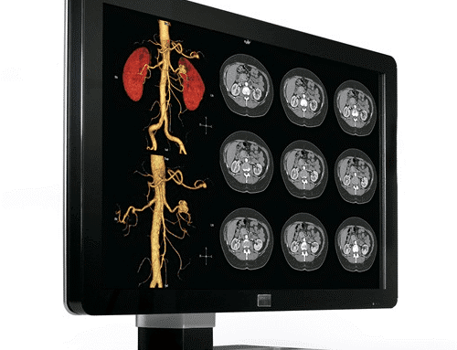 Why Radiology Displays Are a Vital Tool for Teleradiology Services