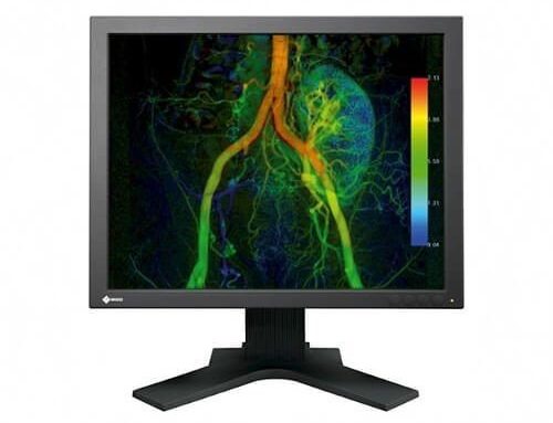 How Diagnostic Monitors Reduce Eye Strain and Fatigue for Radiologists