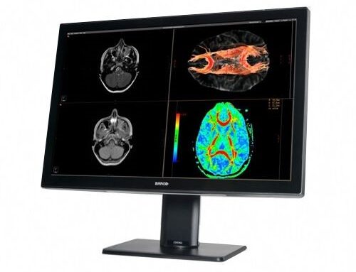 Should you Know Before You Purchase New Barco Monitors for Your Imaging Desk