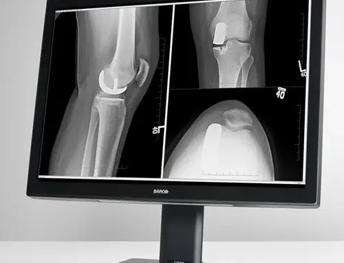 A Window into the Human Body: Barco Radiology Monitors