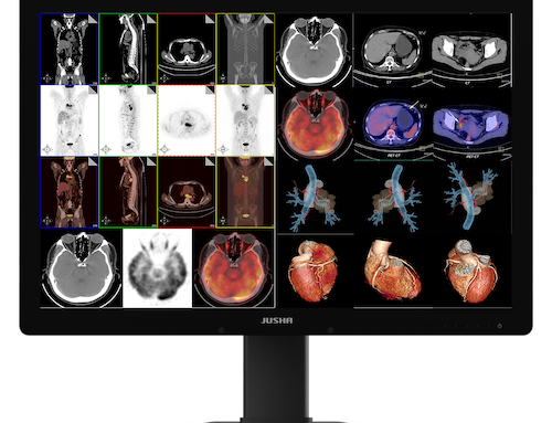 What is Meant by Display in Radiology?