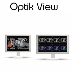 Optik View